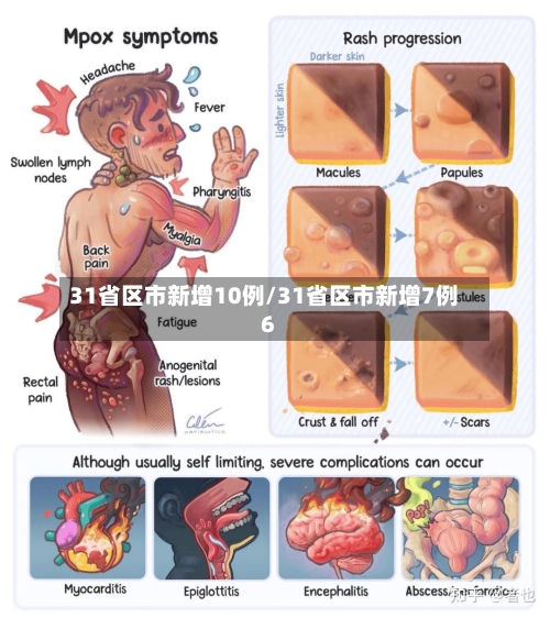 31省区市新增10例/31省区市新增7例6-第1张图片