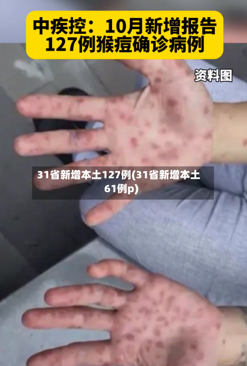 31省新增本土127例(31省新增本土61例p)-第2张图片