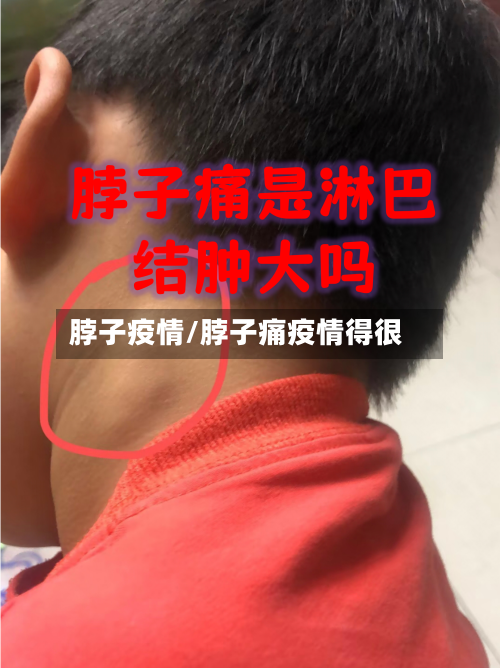 脖子疫情/脖子痛疫情得很-第1张图片